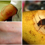 health issues from cockroaches