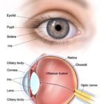 What is coloboma? Treatment, Disease and Symptoms