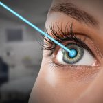 8 Huge Benefits of LASIK Eye Surgery for Working Moms