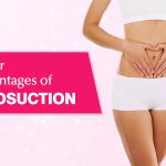 Hire A Liposuction Treatment